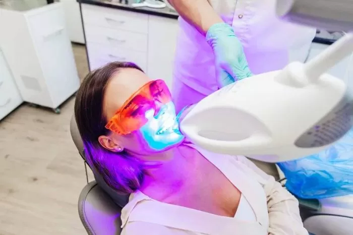 Плюсы и минусы отбеливания зубов: стоит ли делать, показания и противопоказания к процедуре