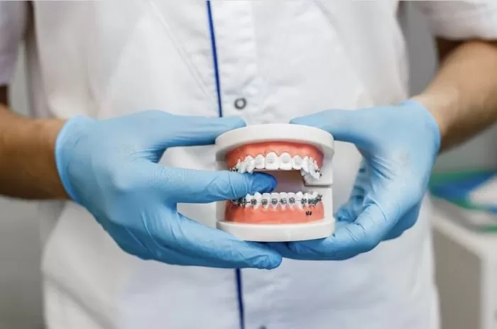 Ортодонтия: виды и особенности лечения