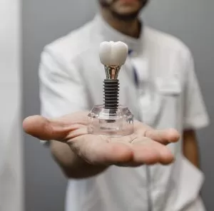 Понятно о зубной имплантации: подготовка, лечение, реабилитация