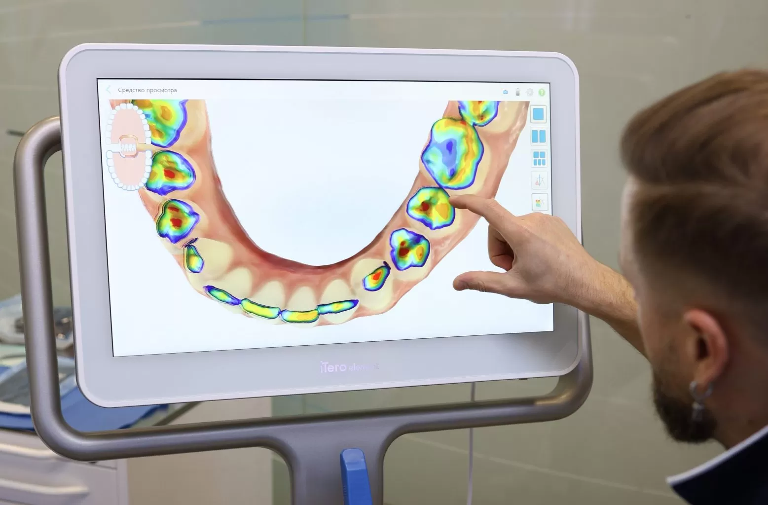 ВСЕ НА 4, ВСЕ НА 6
(ALL-ON-4, ALL-ON-6)