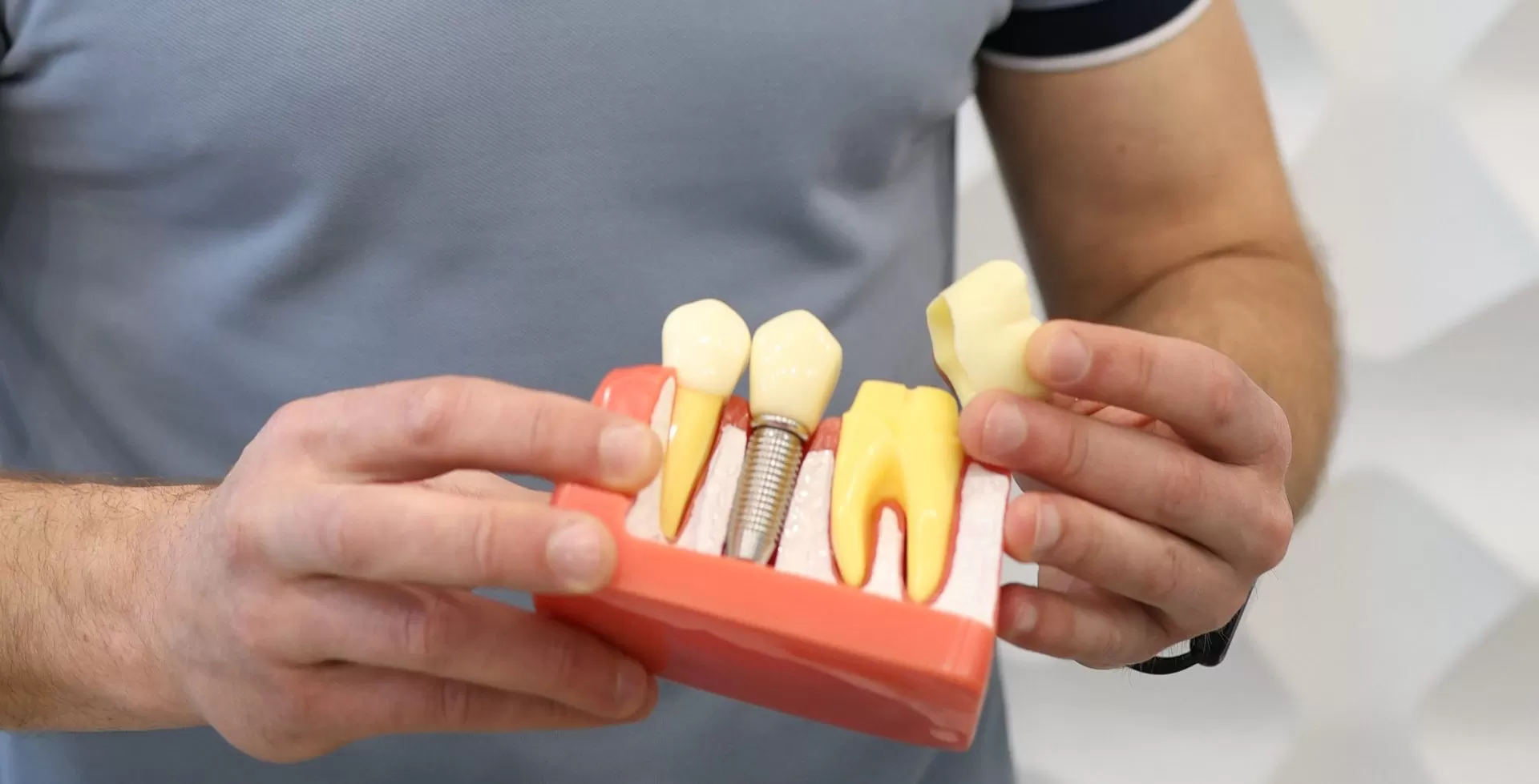 Высокоэстетичные керамические коронки и виниры