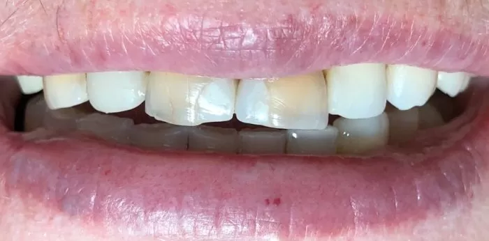 Фото до процедуры