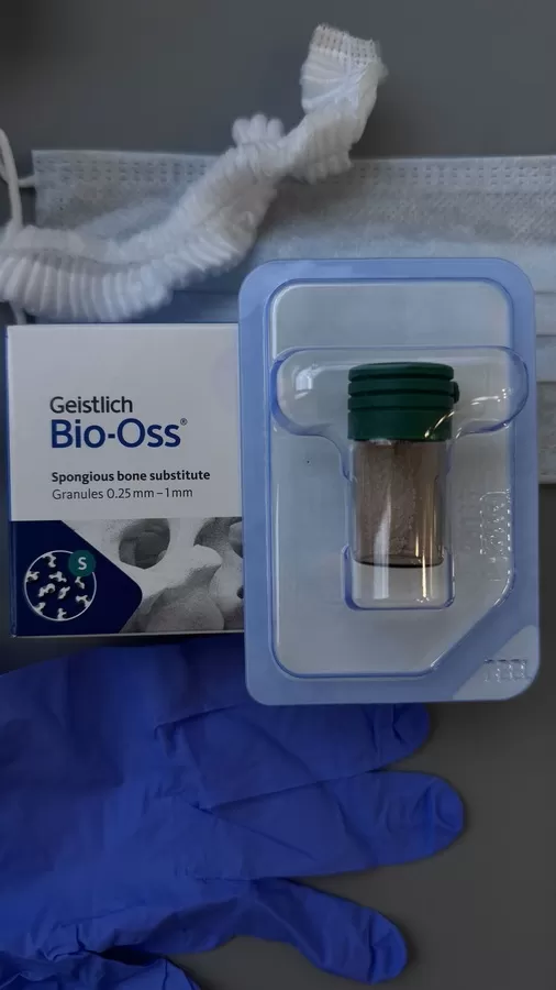 Костная пластика