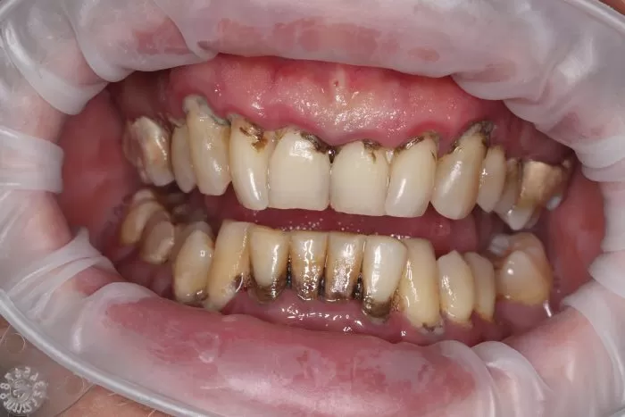 Фото до процедуры