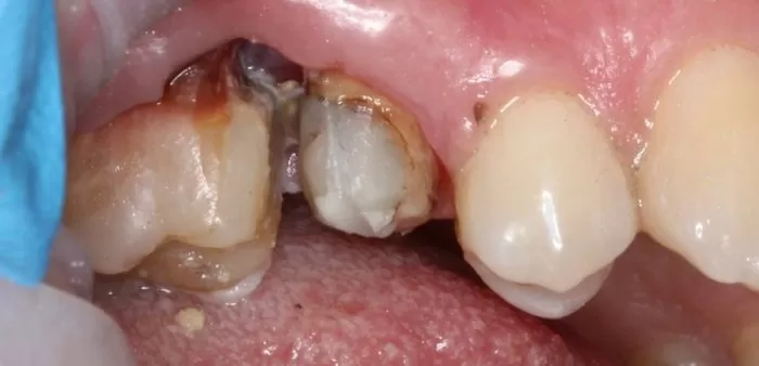 Фото до процедуры