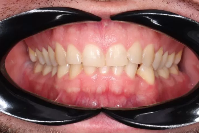 Фото до процедуры