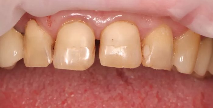 Фото до процедуры