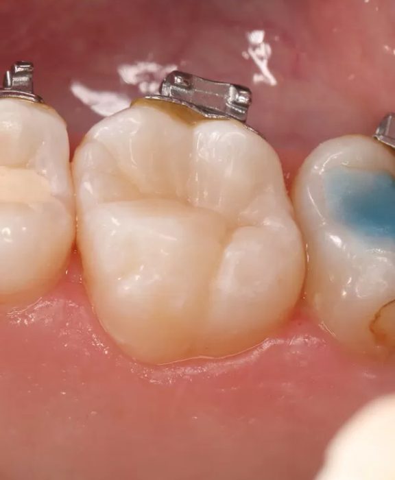 Фото после процедуры