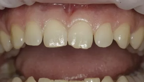 Фото до процедуры