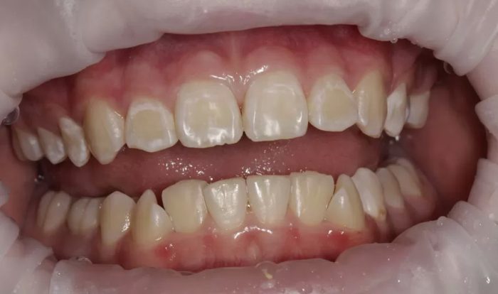 Фото до процедуры