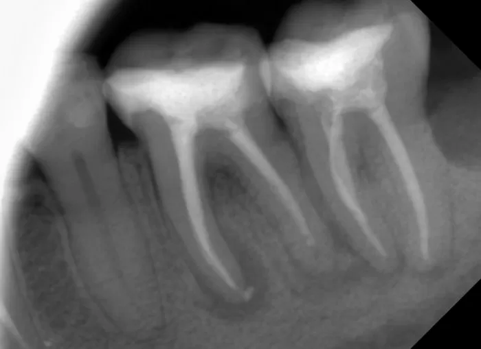 Фото после процедуры